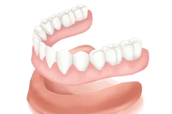 DENTURES