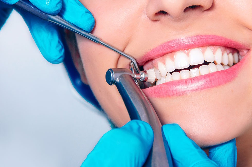 TOOTH CLEANING