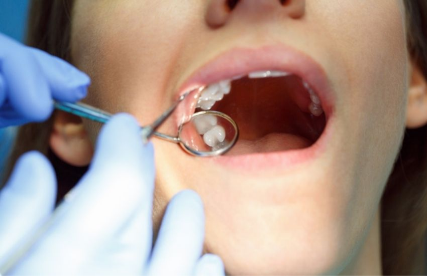 WISDOM TEETH REMOVAL